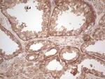 UBE2D2 Antibody in Immunohistochemistry (Paraffin) (IHC (P))