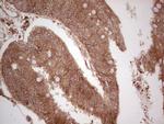 UBE2D2 Antibody in Immunohistochemistry (Paraffin) (IHC (P))