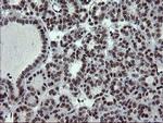 UBE2E3 Antibody in Immunohistochemistry (Paraffin) (IHC (P))