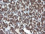 UBE2E3 Antibody in Immunohistochemistry (Paraffin) (IHC (P))