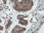 UBE2E3 Antibody in Immunohistochemistry (Paraffin) (IHC (P))