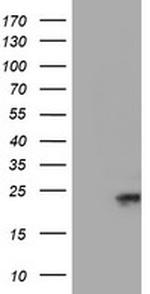 UBE2E3 Antibody in Western Blot (WB)