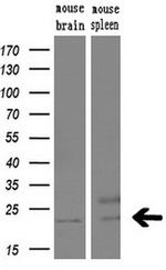 UBE2E3 Antibody in Western Blot (WB)