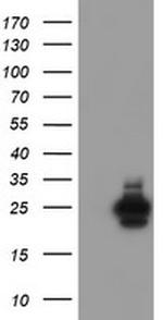 UBE2E3 Antibody in Western Blot (WB)