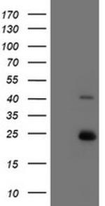 UBE2E3 Antibody in Western Blot (WB)