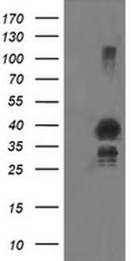 UBE2J1 Antibody in Western Blot (WB)