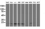 UBE2M Antibody in Western Blot (WB)