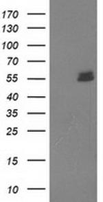 UBOX5 Antibody in Western Blot (WB)