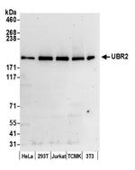 UBR2 Antibody in Western Blot (WB)