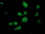 UBXN2B Antibody in Immunocytochemistry (ICC/IF)