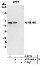 UBXN4 Antibody in Immunoprecipitation (IP)