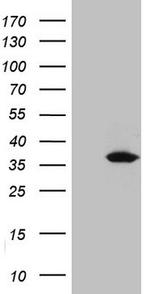 UCK2 Antibody in Western Blot (WB)