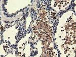 UHMK1 Antibody in Immunohistochemistry (Paraffin) (IHC (P))
