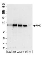UNK Antibody in Western Blot (WB)