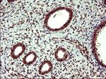 UPRT Antibody in Immunohistochemistry (Paraffin) (IHC (P))