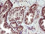 UPRT Antibody in Immunohistochemistry (Paraffin) (IHC (P))