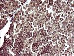 UPRT Antibody in Immunohistochemistry (Paraffin) (IHC (P))