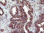 UPRT Antibody in Immunohistochemistry (Paraffin) (IHC (P))