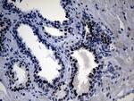 UPRT Antibody in Immunohistochemistry (Paraffin) (IHC (P))