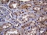 UPRT Antibody in Immunohistochemistry (Paraffin) (IHC (P))