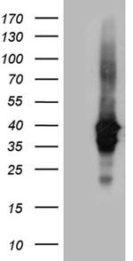 UPRT Antibody in Western Blot (WB)