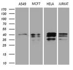 UPRT Antibody in Western Blot (WB)