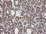 UQCRC1 Antibody in Immunohistochemistry (Paraffin) (IHC (P))