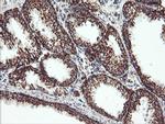 UQCRC1 Antibody in Immunohistochemistry (Paraffin) (IHC (P))