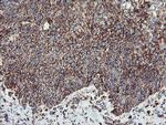 UQCRC1 Antibody in Immunohistochemistry (Paraffin) (IHC (P))