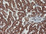 UQCRC1 Antibody in Immunohistochemistry (Paraffin) (IHC (P))