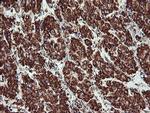 UQCRC1 Antibody in Immunohistochemistry (Paraffin) (IHC (P))