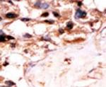 UCKL1 Antibody in Immunohistochemistry (IHC)