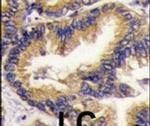 URM1 Antibody in Immunohistochemistry (IHC)