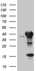 UROD Antibody in Western Blot (WB)