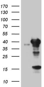 UROD Antibody in Western Blot (WB)