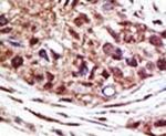 USP14 Antibody in Immunohistochemistry (IHC)