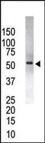 USP14 Antibody in Western Blot (WB)