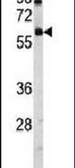 USP14 Antibody in Western Blot (WB)