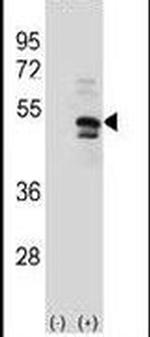 USP14 Antibody in Western Blot (WB)