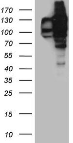 USP25 Antibody in Western Blot (WB)