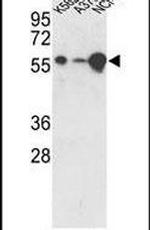 USP3 Antibody in Western Blot (WB)