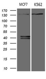 USP40 Antibody in Western Blot (WB)