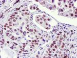 USP7 Antibody in Immunohistochemistry (Paraffin) (IHC (P))