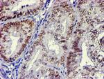 USP7 Antibody in Immunohistochemistry (Paraffin) (IHC (P))