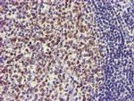 USP7 Antibody in Immunohistochemistry (Paraffin) (IHC (P))