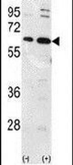 Ubiquilin 1 Antibody in Western Blot (WB)