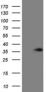 VAPB Antibody in Western Blot (WB)