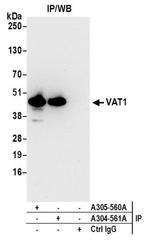 VAT1 Antibody in Western Blot (WB)
