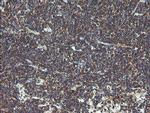 VBP1 Antibody in Immunohistochemistry (Paraffin) (IHC (P))