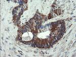 VBP1 Antibody in Immunohistochemistry (Paraffin) (IHC (P))